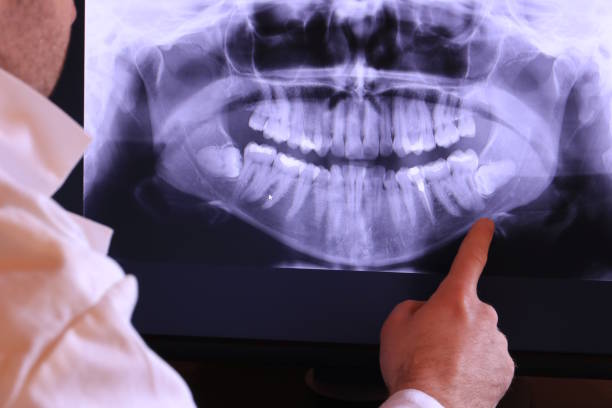 Best Broken or Cracked Tooth Emergency Dentist in Collinsville, VA