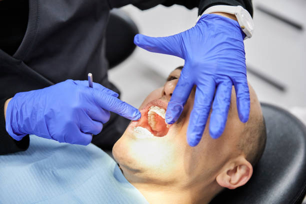Best Emergency Dentist for Lost Fillings or Crowns in Collinsville, VA