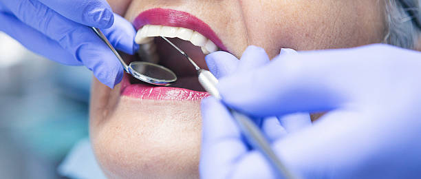 Best Emergency Root Canal Treatment in Collinsville, VA